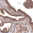 Immunohistochemical staining of human fallopian tube shows moderate membranous and cytoplasmic positivity in glandular cells.