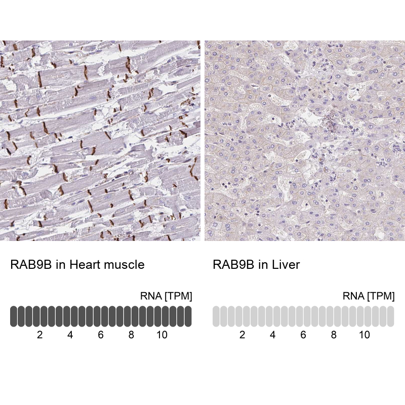 Anti-RAB9B Antibody