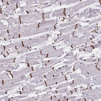 Immunohistochemical staining of human heart muscle shows high expression.