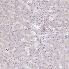 Anti-RAB9B Antibody