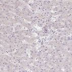 Immunohistochemical staining of human liver shows low expression as expected.