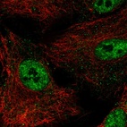 Anti-NR0B1 Antibody