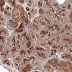 Anti-FXYD5 Antibody