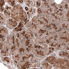 Immunohistochemical staining of human pancreas shows strong membranous positivity in exocrine glandular cells.