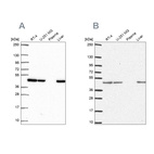 Anti-NDUFS2 Antibody