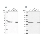 Western blot analysis using Anti-NDUFS2 antibody HPA061953 (A) shows similar pattern to independent antibody HPA055140 (B).