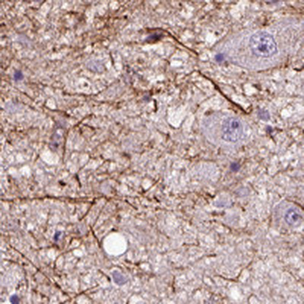 Anti-ADRB3 Antibody