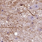 Anti-ADRB3 Antibody