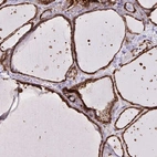 Immunohistochemical staining of human thyroid gland shows high expression.