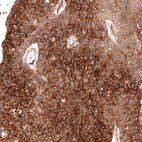 Anti-FXYD5 Antibody