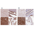 Anti-RPS5 Antibody