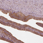 Anti-RPS5 Antibody