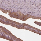 Immunohistochemical staining of human fallopian tube shows moderate cytoplasmic-nucleoli positivity in glandular cells.