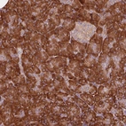 Immunohistochemical staining of human pancreas shows strong cytoplasmic-nucleoli positivity in exocrine glandular cells.