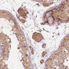 Anti-RPS5 Antibody