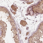 Immunohistochemical staining of human testis shows moderate cytoplasmic-nucleoli positivity in Leydig cells.