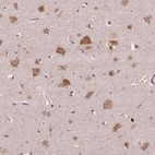 Immunohistochemical staining of human cerebral cortex shows strong cytoplasmic-nucleoli positivity in neurons.