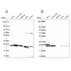 Western blot analysis using Anti-RPS5 antibody HPA061979 (A) shows similar pattern to independent antibody HPA055878 (B).