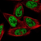 Immunofluorescent staining of human cell line RH-30 shows localization to nuclear speckles.