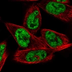 Immunofluorescent staining of human cell line RH-30 shows localization to nuclear speckles.