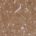 Immunohistochemical staining of human cerebral cortex shows high expression.