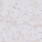 Immunohistochemical staining of human skeletal muscle shows low expression as expected.