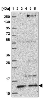 Lane 1: Marker [kDa] 250, 130, 95, 72, 55, 36, 28, 17, 10_br/_Lane 2: Human cell line RT-4_br/_Lane 3: Human cell line U-251 MG_br/_Lane 4: Human plasma_br/_Lane 5: Human Liver tissue_br/_Lane 6: Human Tonsil tissue