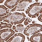 Anti-STOML2 Antibody
