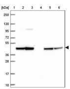 Lane 1: Marker [kDa] 250, 130, 95, 72, 55, 36, 28, 17, 10_br/_Lane 2: Human cell line RT-4_br/_Lane 3: Human cell line U-251 MG_br/_Lane 4: Human plasma_br/_Lane 5: Human Liver tissue_br/_Lane 6: Human Tonsil tissue