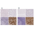 Anti-PRL Antibody
