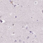 Immunohistochemical staining of human cerebral cortex using Anti-PRL antibody HPA062017.
