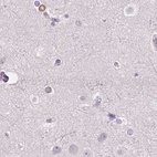 Anti-PRL Antibody