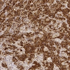 Immunohistochemical staining of human pituitary gland shows strong positivity.