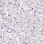 Immunohistochemical staining of human liver using Anti-PRL antibody HPA062017.