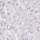 Anti-PRL Antibody