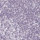 Immunohistochemical staining of human lymph node using Anti-PRL antibody HPA062017.