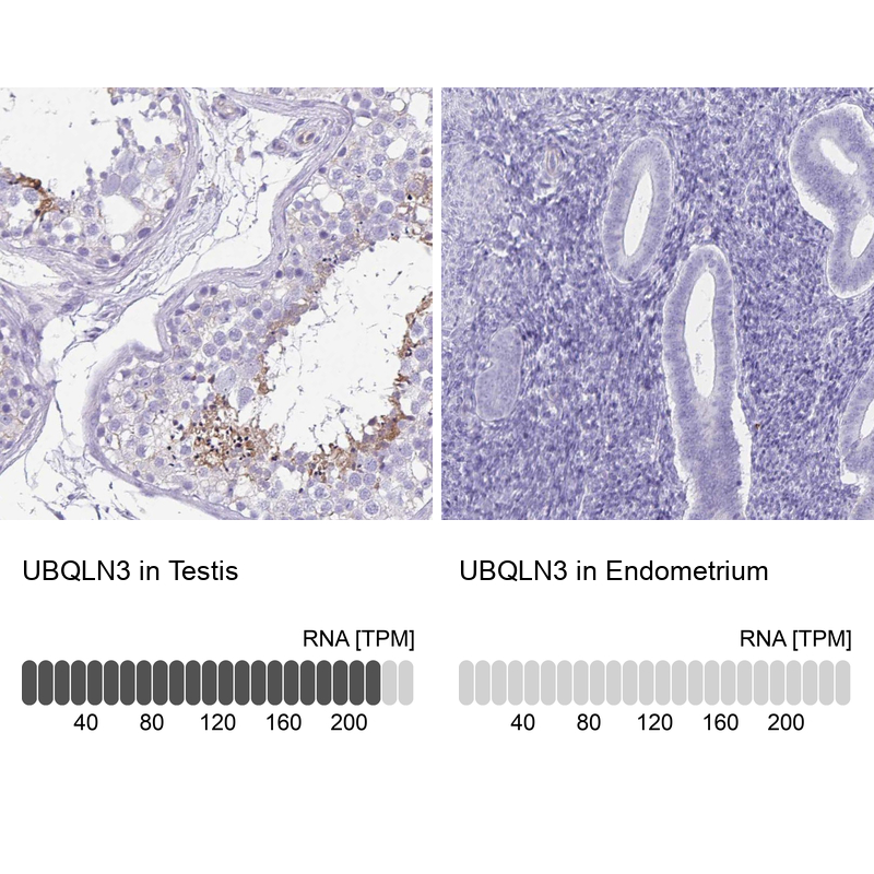 Anti-UBQLN3 Antibody