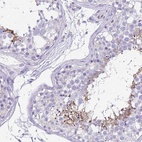 Anti-UBQLN3 Antibody