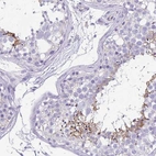 Immunohistochemical staining of human testis shows high expression.