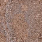 Immunohistochemical staining of human tonsil shows moderate membranous positivity in lymphoid cells.