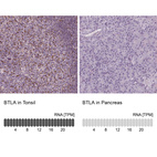 Anti-BTLA Antibody