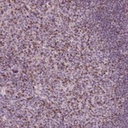 Immunohistochemical staining of human tonsil shows moderate positivity in lymphoid cells.