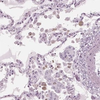 Immunohistochemical staining of human lung shows moderate cytoplasmic positivity in macrophages.