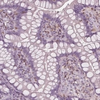 Immunohistochemical staining of human small intestine shows moderate positivity in lymphoid cells.