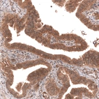 Immunohistochemical staining of human fallopian tube shows moderate membranous and cytoplasmic positivity in glandular cells.