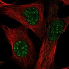 Anti-TMEM179B Antibody