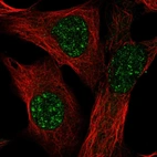 Anti-TMEM179B Antibody