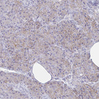 Anti-ENPP1 Antibody