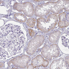 Anti-ENPP1 Antibody