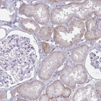 Immunohistochemical staining of human kidney shows moderate cytoplasmic positivity in cells in tubules.